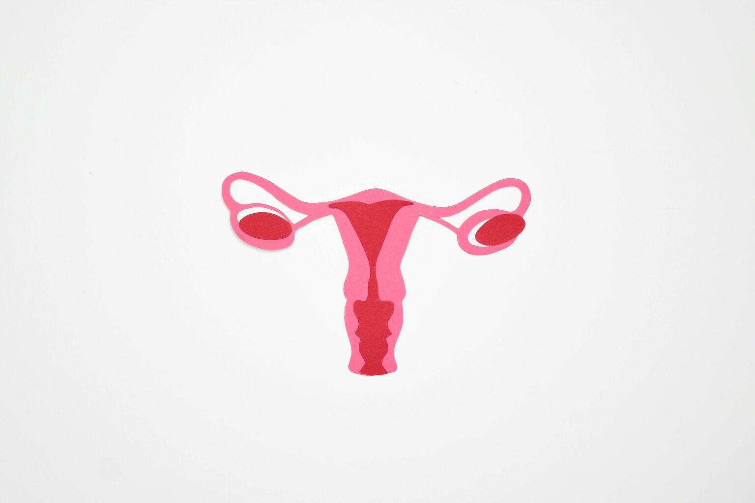 A picture of a female reproductive system showing ovaries, fallopian tubes, vaginal canal and cervix depicting PCOS>